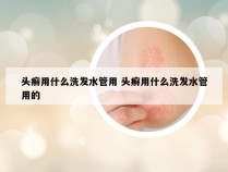 头癣用什么洗发水管用 头癣用什么洗发水管用的