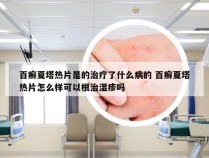 百癣夏塔热片是的治疗了什么病的 百癣夏塔热片怎么样可以根治湿疹吗