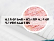 身上有毛的地方都长癣怎么回事 身上有毛的地方都长癣怎么回事图片