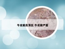 牛皮廨高发区 牛皮廨严重