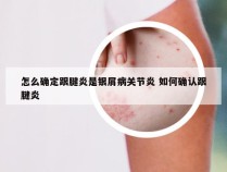 怎么确定跟腱炎是银屑病关节炎 如何确认跟腱炎