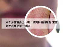 六个月宝宝身上一块一块类似癣的东西 宝宝六个月身上有一块藓