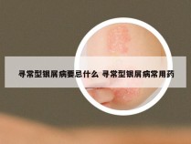 寻常型银屑病要忌什么 寻常型银屑病常用药