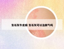 生石灰牛皮癣 生石灰可以治脚气吗