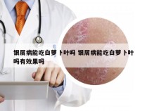 银屑病能吃白萝卜叶吗 银屑病能吃白萝卜叶吗有效果吗