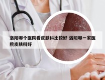 洛阳哪个医院看皮肤科比较好 洛阳哪一家医院皮肤科好