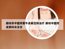 廊坊市中医院看牛皮癣怎样治疗 廊坊中医院皮肤科石主任