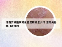 淮南济民医院吴化德皮肤科怎么样 淮南吴化德门诊预约