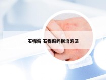 石棉癣 石棉癣的根治方法