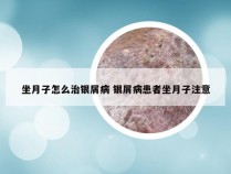 坐月子怎么治银屑病 银屑病患者坐月子注意