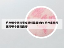 杭州哪个医院看皮肤科是最好的 杭州皮肤科医院哪个医院最好