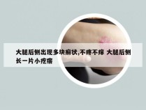 大腿后侧出现多块癣状,不疼不痒 大腿后侧长一片小疙瘩