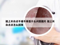 腿上长白点不痛不痒是什么问题图片 腿上长白点点怎么回事