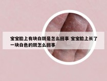 宝宝脸上有块白斑是怎么回事 宝宝脸上长了一块白色的斑怎么回事