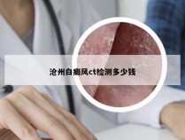 沧州白癜风ct检测多少钱