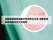 成都银康银屑病医学研究院怎么样 成都银康银屑病医院怎么样贴吧