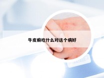 牛皮癣吃什么对这个病好