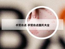 手臂白点 手臂白点图片大全