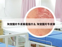 淘宝图片牛皮癣是指什么 淘宝图片牛皮鲜