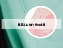 藓是怎么来的 癣的来源