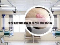 中医治愈银屑病医案 中医治银屑病药方