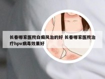 长春哪家医院白癜风治的好 长春哪家医院治疗hpv病毒效果好