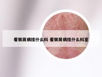 看银屑病挂什么科 看银屑病挂什么科室