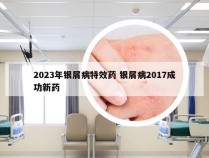 2023年银屑病特效药 银屑病2017成功新药