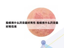 股癣用什么药膏最好男性 股癣用什么药膏最好男性用