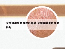 河南省那里的皮肤科最好 河南省哪里的皮肤科好