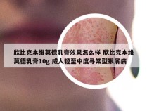 欣比克本维莫德乳膏效果怎么样 欣比克本维莫德乳膏10g 成人轻至中度寻常型银屑病