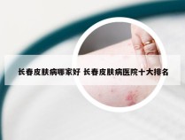 长春皮肤病哪家好 长春皮肤病医院十大排名