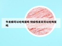 牛皮癣可以吃鸡蛋吗 特应性皮炎可以吃鸡蛋吗