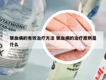 银血病的有效治疗方法 银血病的治疗原则是什么