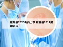 银屑病2023新药上市 银屑病2017成功新药