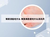 银屑消能吃什么 银屑病患者吃什么消炎药