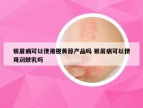 银屑病可以使用视黄醇产品吗 银屑病可以使用润肤乳吗