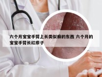 六个月宝宝手臂上长类似癣的东西 六个月的宝宝手臂长红疹子