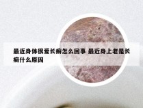 最近身体很爱长癣怎么回事 最近身上老是长癣什么原因