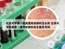 北京大学第一附属医院皮肤科怎么样 北京大学附属第一医院皮肤科出名医生号码