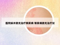 医院脉冲激光治疗银屑病 银屑病激光治疗仪