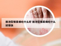 脓泡型银屑病吃什么好 脓泡型银屑病吃什么好得快