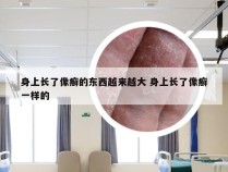 身上长了像癣的东西越来越大 身上长了像癣一样的