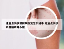 儿童点滴状银屑病反复怎么回事 儿童点滴状银屑病终身不犯