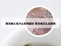 银消病人吃什么食物最好 银消病怎么治除根