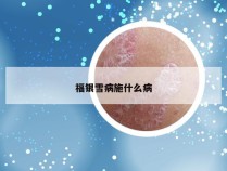 福银雪病施什么病