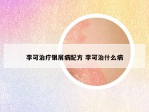 李可治疗银屑病配方 李可治什么病