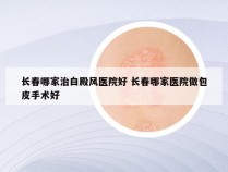 长春哪家治白殿风医院好 长春哪家医院做包皮手术好