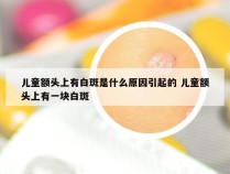 儿童额头上有白斑是什么原因引起的 儿童额头上有一块白斑