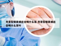 寻常型银屑病适合喝什么茶 寻常型银屑病适合喝什么茶叶